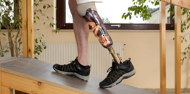 Management of residual limb pain