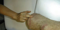 Massage Therapy 03