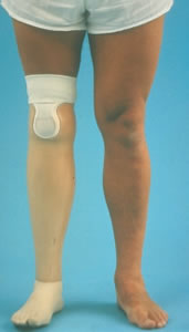 Transtibial Suspension 05