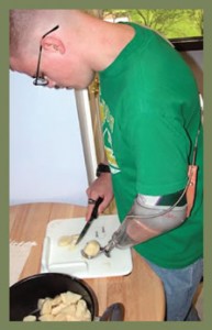 Prosthetic Devices for Upper-Extremity Amputees 06