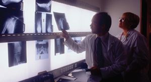 The Transfemoral Amputation Level, Part 1 02