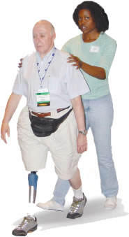 The Transfemoral Amputation Level, Part 5 03