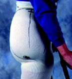Fitting for Hip Disarticulation IMG 03