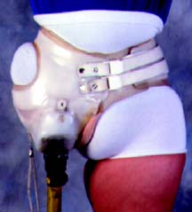 Fitting for Hip Disarticulation IMG 06