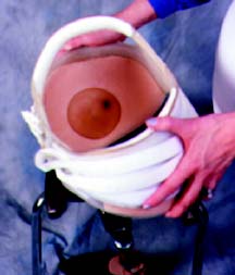 Fitting for Hip Disarticulation IMG 10