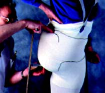 Fitting for Hip Disarticulation IMG 16