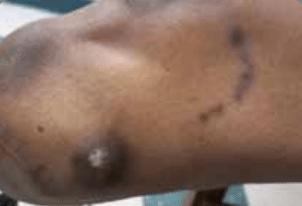 Skin Issues Lower img 01