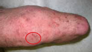Skin Issues Lower img 03