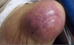 Skin Issues Lower img 05