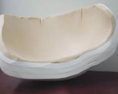 The Pelvic Leveler IMG 04