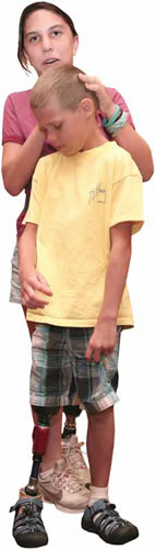 Teen girl and younger boy, each wearing a prosthetic leg