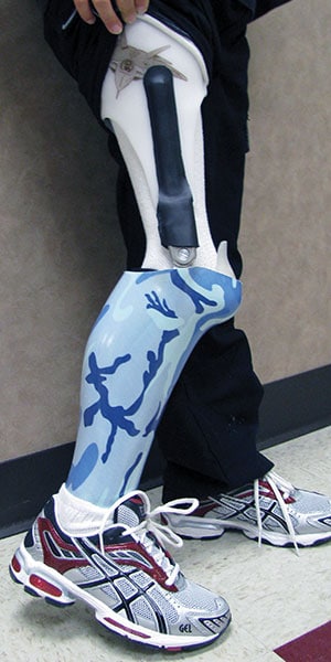 An Unusual Fit