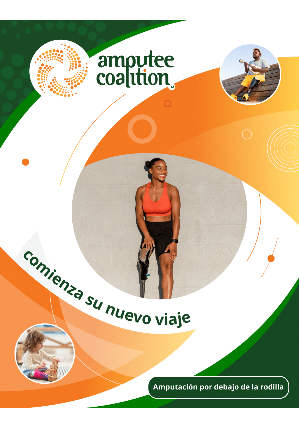 AMPUTACIÓN POR DEBAJO DE LA RODILLA